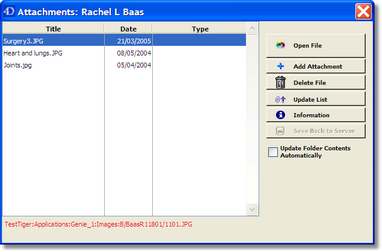 addingattachment3
